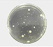 E. Coli before disinfection